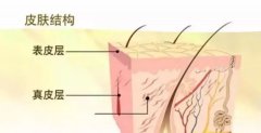 夏日纹绣怎么才能预防感染？